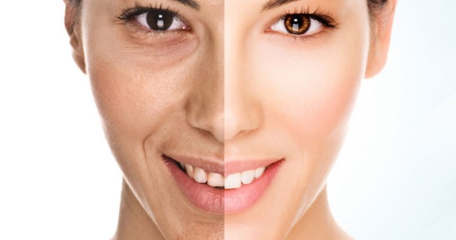 ХИМИЧНИ ПИЛИНГИ Dermaceutic Laboratoire 